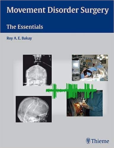 Movement Disorder Surgery The Essentials 1st Edition EMEDICAL BOOKS