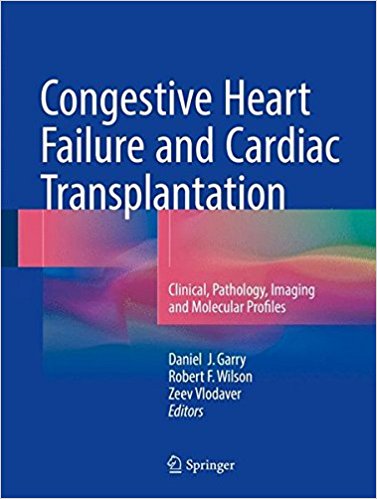 Congestive Heart Failure and Cardiac Transplantation: Clinical ...