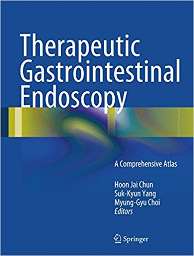 Therapeutic Gastrointestinal Endoscopy: A Comprehensive Atlas 1st ed ⋆ ...