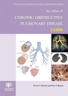 Atlas of Chronic Obstructive Pulmonary Disease ⋆ eMEDICAL BOOKS