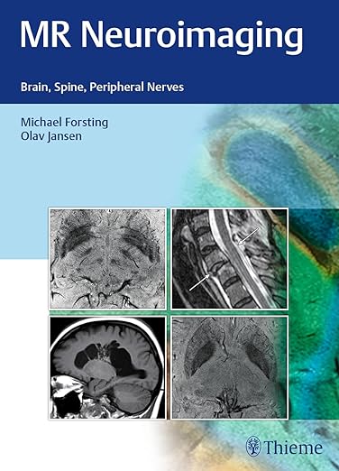 MR Neuroimaging: Brain, Spine, Peripheral Nerves 1st Edition ⋆ eMEDICAL ...