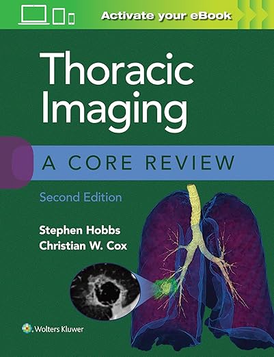 Thoracic Imaging: A Core Review 2nd Edition ⋆ Emedical Books